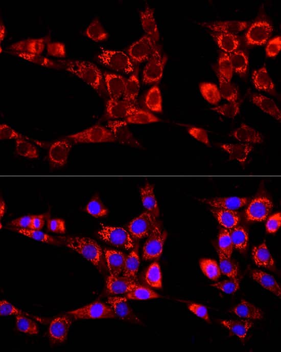 Immunocytochemistry/ Immunofluorescence: ATG13 Antibody [NBP3-35082] - Immunofluorescence analysis of NIH/3T3 cells using ATG13 Rabbit pAb at dilution of 1:100 (40x lens). Secondary antibody: Cy3-conjugated Goat anti-Rabbit IgG (H+L) at 1:500 dilution. Blue: DAPI for nuclear staining.