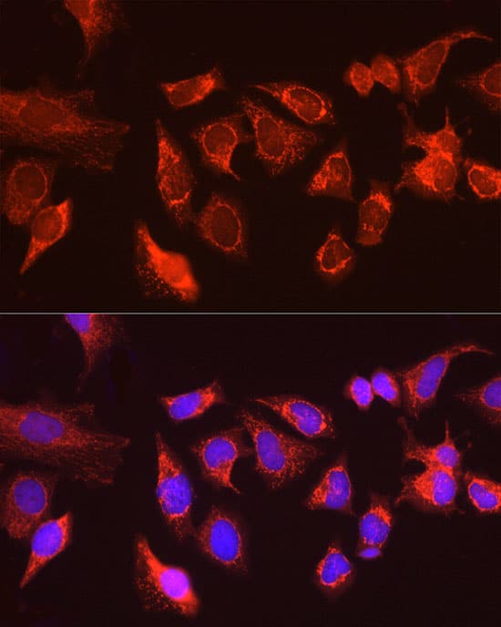 Immunocytochemistry/ Immunofluorescence: ATG13 Antibody [NBP3-35082] - Immunofluorescence analysis of HeLa cells using ATG13 Rabbit pAb at dilution of 1:100 (40x lens). Secondary antibody: Cy3-conjugated Goat anti-Rabbit IgG (H+L) at 1:500 dilution. Blue: DAPI for nuclear staining.