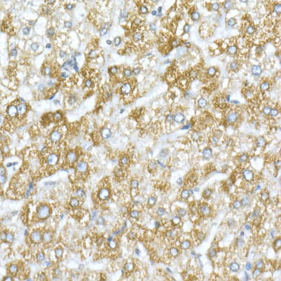 Immunohistochemistry: VDAC1 Antibody [NBP3-35084] - Immunohistochemistry analysis of paraffin-embedded Human liver using VDAC1 Rabbit pAb at dilution of 1:20 (40x lens). High pressure antigen retrieval performed with 0.01M Citrate Bufferr (pH 6.0) prior to IHC staining.