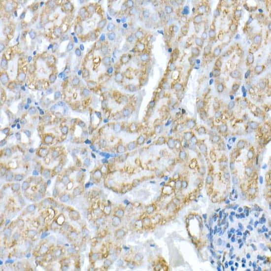 Immunohistochemistry: VDAC1 Antibody [NBP3-35084] - Immunohistochemistry analysis of paraffin-embedded Rat liver using VDAC1 Rabbit pAb at dilution of 1:20 (40x lens). High pressure antigen retrieval performed with 0.01M Citrate Bufferr (pH 6.0) prior to IHC staining.