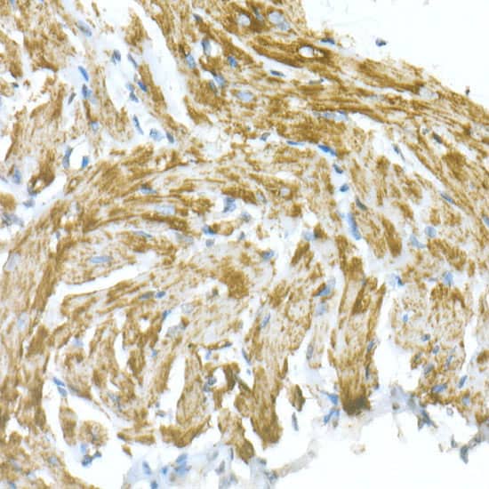 Immunohistochemistry: VDAC1 Antibody [NBP3-35084] - Immunohistochemistry analysis of paraffin-embedded Mouse heart using VDAC1 Rabbit pAb at dilution of 1:20 (40x lens). High pressure antigen retrieval performed with 0.01M Citrate Bufferr (pH 6.0) prior to IHC staining.