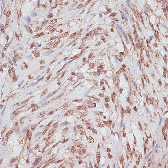 Immunohistochemistry: RPA70 Antibody [NBP3-35085] - Immunohistochemistry analysis of paraffin-embedded Human uterus using RPA70 Rabbit pAb at dilution of 1:100 (40x lens). Microwave antigen retrieval performed with 0.01M PBS Buffer (pH 7.2) prior to IHC staining.