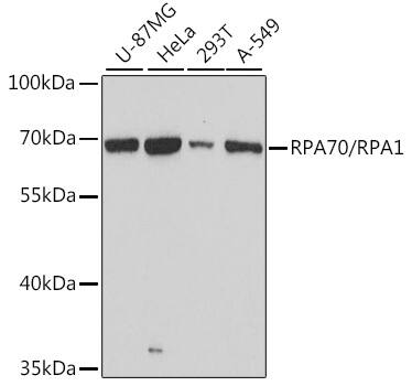 Western Blot: RPA70 Antibody [NBP3-35085] - Western blot analysis of various lysates using RPA70 Rabbit pAb at 1:3000 dilution.Secondary antibody: HRP-conjugated Goat anti-Rabbit IgG (H+L) at 1:10000 dilution.Lysates/proteins: 25ug per lane.Blocking buffer: 3% nonfat dry milk in TBST.Detection: ECL Basic Kit.Exposure time: 30s.