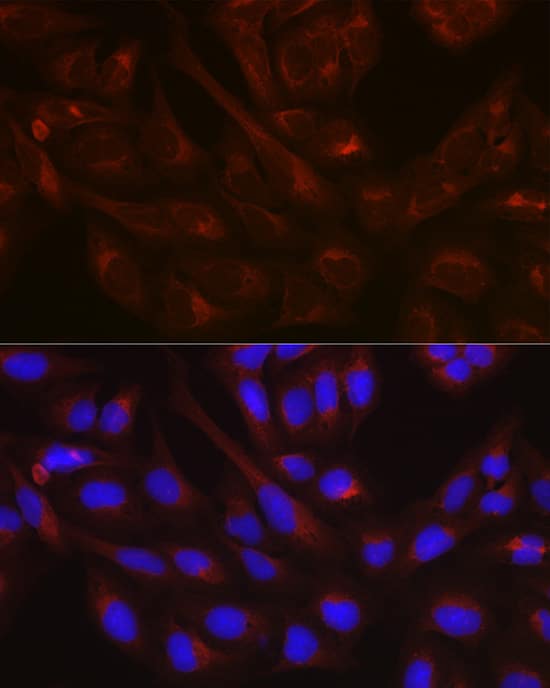 Immunocytochemistry/ Immunofluorescence: NSF Antibody [NBP3-35086] - Immunofluorescence analysis of U-2 OS cells using NSF Rabbit pAb at dilution of 1:100 (40x lens). Secondary antibody: Cy3-conjugated Goat anti-Rabbit IgG (H+L) at 1:500 dilution. Blue: DAPI for nuclear staining.