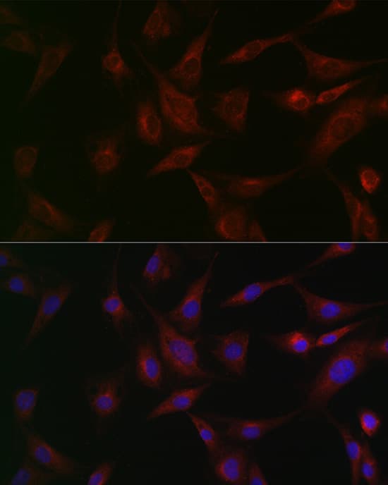 Immunocytochemistry/ Immunofluorescence: NSF Antibody [NBP3-35086] - Immunofluorescence analysis of BALB-3T3 cells using NSF Rabbit pAb at dilution of 1:100 (40x lens). Secondary antibody: Cy3-conjugated Goat anti-Rabbit IgG (H+L) at 1:500 dilution. Blue: DAPI for nuclear staining.