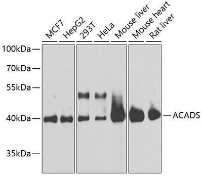 Western Blot: ACADS Antibody [NBP3-35087] - Western blot analysis of various lysates using ACADS Rabbit pAb at 1:1000 dilution.Secondary antibody: HRP-conjugated Goat anti-Rabbit IgG (H+L) at 1:10000 dilution.Lysates/proteins: 25ug per lane.Blocking buffer: 3% nonfat dry milk in TBST.Detection: ECL Basic Kit.Exposure time: 15s.