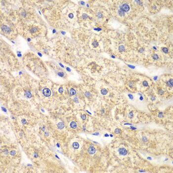 Immunohistochemistry: ACADS Antibody [NBP3-35087] - Immunohistochemistry analysis of paraffin-embedded Human liver damage using ACADS Rabbit pAb at dilution of 1:100 (40x lens). Microwave antigen retrieval performed with 0.01M PBS Buffer (pH 7.2) prior to IHC staining.