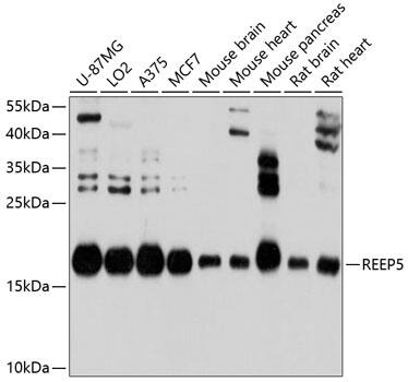 Western Blot: REEP5 Antibody [NBP3-35088] - Western blot analysis of various lysates using REEP5 Rabbit pAb at 1:1000 dilution.Secondary antibody: HRP-conjugated Goat anti-Rabbit IgG (H+L) at 1:10000 dilution.Lysates/proteins: 25ug per lane.Blocking buffer: 3% nonfat dry milk in TBST.Detection: ECL Basic Kit.Exposure time: 1s.