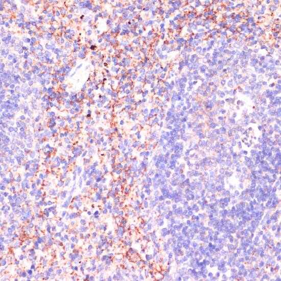 Immunohistochemistry: RAP1A Antibody [NBP3-35089] - Immunohistochemistry analysis of paraffin-embedded Mouse spleen using [KO Validated] RAP1A Rabbit pAb at dilution of 1:100 (40x lens). Microwave antigen retrieval performed with 0.01M PBS Buffer (pH 7.2) prior to IHC staining.