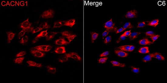 Immunocytochemistry/ Immunofluorescence CACNG1 Antibody