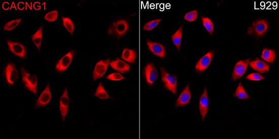 Immunocytochemistry/ Immunofluorescence CACNG1 Antibody