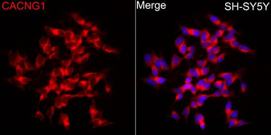 Immunocytochemistry/ Immunofluorescence CACNG1 Antibody