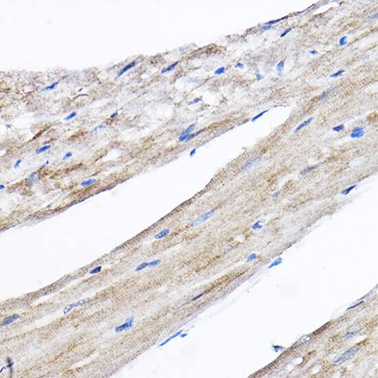 Immunohistochemistry RPL8 Antibody - BSA Free
