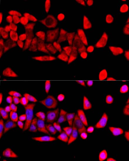 Immunocytochemistry/ Immunofluorescence: RPL8 Antibody [NBP3-35097] - Immunofluorescence analysis of HeLa cells using RPL8 Rabbit pAb at dilution of 1:100 (40x lens). Secondary antibody: Cy3-conjugated Goat anti-Rabbit IgG (H+L) at 1:500 dilution. Blue: DAPI for nuclear staining.