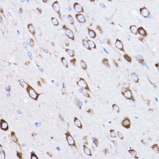 Immunohistochemistry: RPL8 Antibody [NBP3-35097] - Immunohistochemistry analysis of paraffin-embedded Rat brain using RPL8 Rabbit pAb at dilution of 1:50 (40x lens). High pressure antigen retrieval performed with 0.01M Citrate Bufferr (pH 6.0) prior to IHC staining.