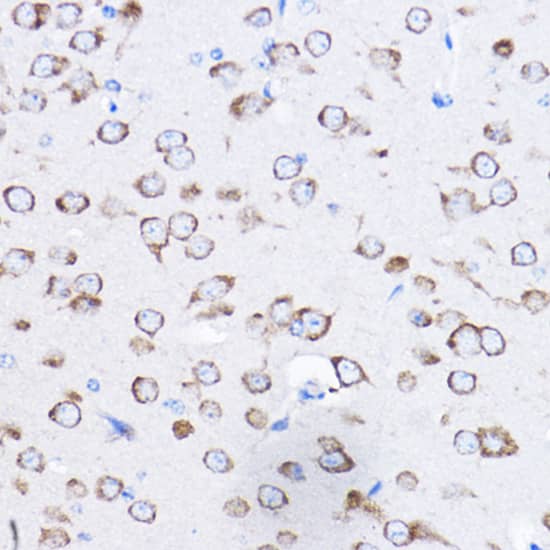Immunohistochemistry: RPL8 Antibody [NBP3-35097] - Immunohistochemistry analysis of paraffin-embedded Mouse brain using RPL8 Rabbit pAb at dilution of 1:50 (40x lens). High pressure antigen retrieval performed with 0.01M Citrate Bufferr (pH 6.0) prior to IHC staining.