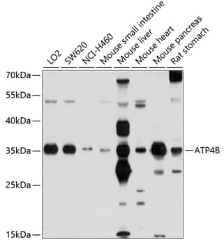 Western Blot: Hydrogen Potassium ATPase Beta Antibody [NBP3-35098] - Western blot analysis of various lysates using Hydrogen Potassium ATPase Beta Rabbit pAb at 1:1000 dilution.Secondary antibody: HRP-conjugated Goat anti-Rabbit IgG (H+L) at 1:10000 dilution.Lysates/proteins: 25ug per lane.Blocking buffer: 3% nonfat dry milk in TBST.Detection: ECL Basic Kit.Exposure time: 30s.