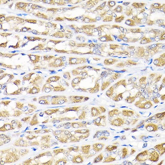 Immunohistochemistry: IKBKAP Antibody [NBP3-35099] - Immunohistochemistry analysis of paraffin-embedded Rat stomach using IKBKAP Rabbit pAb at dilution of 1:100 (40x lens). High pressure antigen retrieval performed with 0.01M Citrate Bufferr (pH 6.0) prior to IHC staining.