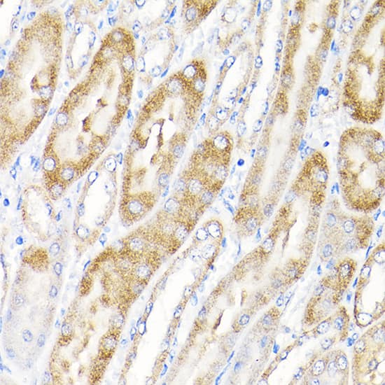 Immunohistochemistry: IKBKAP Antibody [NBP3-35099] - Immunohistochemistry analysis of paraffin-embedded Mouse kidney using IKBKAP Rabbit pAb at dilution of 1:100 (40x lens). High pressure antigen retrieval performed with 0.01M Citrate Bufferr (pH 6.0) prior to IHC staining.