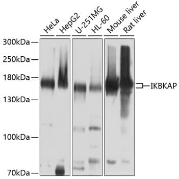 Western Blot: IKBKAP Antibody [NBP3-35099] - Western blot analysis of various lysates using IKBKAP Rabbit pAb at 1:1000 dilution.Secondary antibody: HRP-conjugated Goat anti-Rabbit IgG (H+L) at 1:10000 dilution.Lysates/proteins: 25ug per lane.Blocking buffer: 3% nonfat dry milk in TBST.Detection: ECL Basic Kit.Exposure time: 10s.