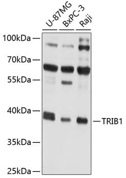 Western Blot: TRIB1 Antibody [NBP3-35100] - Western blot analysis of various lysates using TRIB1 Rabbit pAb at 1:1000 dilution.Secondary antibody: HRP-conjugated Goat anti-Rabbit IgG (H+L) at 1:10000 dilution.Lysates/proteins: 25ug per lane.Blocking buffer: 3% nonfat dry milk in TBST.Detection: ECL Basic Kit.Exposure time: 5s.