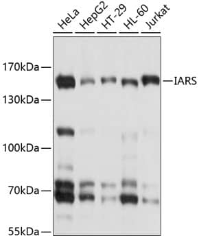 Western Blot Isoleucyl tRNA synthetase Antibody