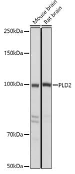 Western Blot: Phospholipase D2 Antibody [NBP3-35105] - Western blot analysis of various lysates using Phospholipase D2 Rabbit pAb at 1:500 dilution.Secondary antibody: HRP-conjugated Goat anti-Rabbit IgG (H+L) at 1:10000 dilution.Lysates/proteins: 25ug per lane.Blocking buffer: 3% nonfat dry milk in TBST.Detection: ECL Basic Kit.Exposure time: 1s.