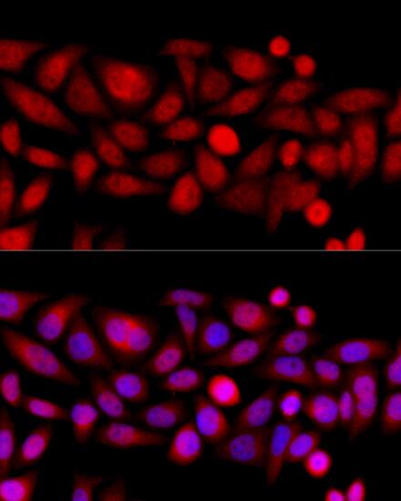 Immunocytochemistry/ Immunofluorescence Kif4A Antibody