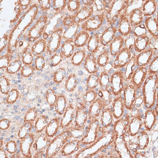 Immunohistochemistry: Kif4A Antibody [NBP3-35106] - Immunohistochemistry analysis of paraffin-embedded Mouse kidney using Kif4A Rabbit pAb at dilution of 1:100 (40x lens). Microwave antigen retrieval performed with 0.01M PBS Buffer (pH 7.2) prior to IHC staining.