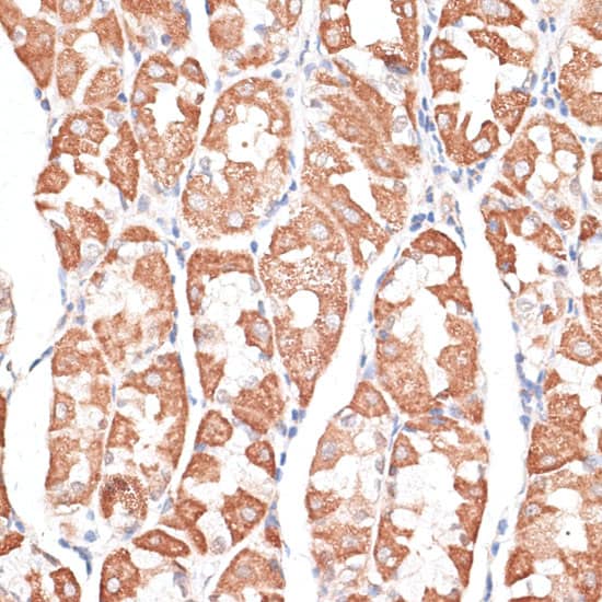 Immunohistochemistry Kif4A Antibody