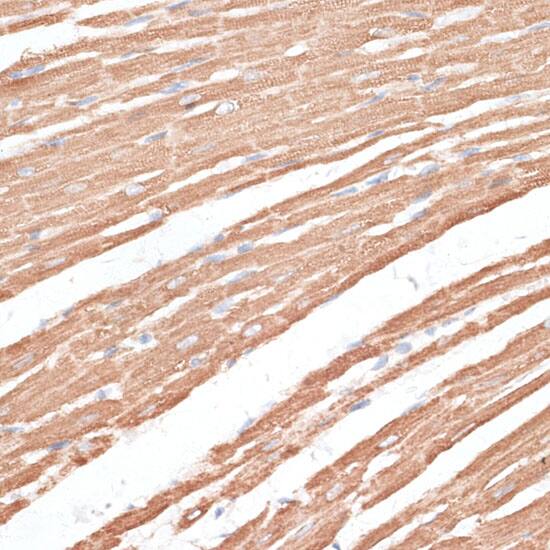 Immunohistochemistry: Kif4A Antibody [NBP3-35106] - Immunohistochemistry analysis of paraffin-embedded Rat heart using Kif4A Rabbit pAb at dilution of 1:100 (40x lens). Microwave antigen retrieval performed with 0.01M PBS Buffer (pH 7.2) prior to IHC staining.