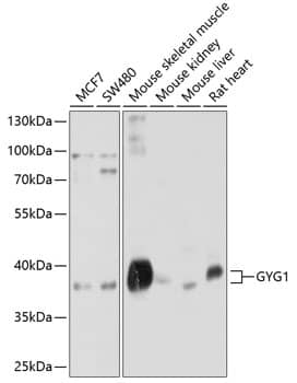 Western Blot: Glycogenin 1 Antibody [NBP3-35107] - Western blot analysis of various lysates using Glycogenin 1 Rabbit pAb at 1:1000 dilution.Secondary antibody: HRP-conjugated Goat anti-Rabbit IgG (H+L) at 1:10000 dilution.Lysates/proteins: 25ug per lane.Blocking buffer: 3% nonfat dry milk in TBST.Detection: ECL Basic Kit.Exposure time: 5s.