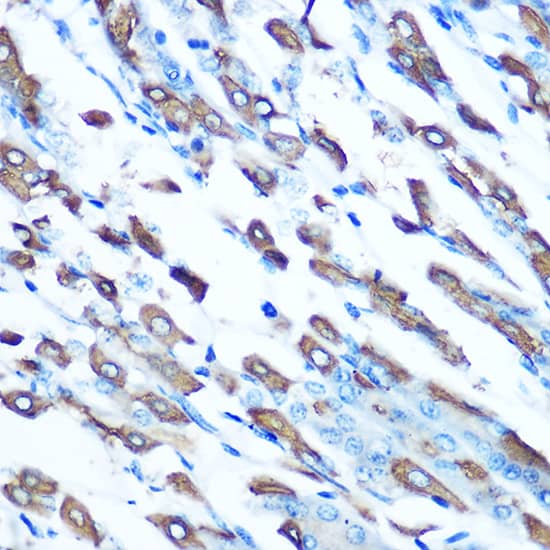 Immunohistochemistry NRAMP2/SLC11A2/DMT1 Antibody