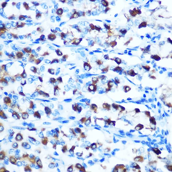 Immunohistochemistry: NRAMP2/SLC11A2/DMT1 Antibody [NBP3-35108] - Immunohistochemistry analysis of paraffin-embedded Rat stomach using NRAMP2/SLC11A2/DMT1 Rabbit pAb at dilution of 1:100 (40x lens). Microwave antigen retrieval performed with 0.01M Tris/EDTA Buffer (pH 9.0) prior to IHC staining.