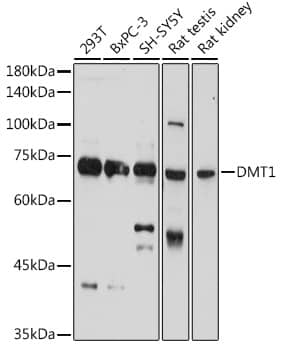 Western Blot: NRAMP2/SLC11A2/DMT1 Antibody [NBP3-35108] - Western blot analysis of various lysates using NRAMP2/SLC11A2/DMT1 Rabbit pAb at 1:1000 dilution.Secondary antibody: HRP-conjugated Goat anti-Rabbit IgG (H+L) at 1:10000 dilution.Lysates/proteins: 25ug per lane.Blocking buffer: 3% nonfat dry milk in TBST.Detection: ECL Basic Kit.Exposure time: 180s.