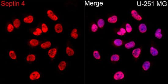 Immunocytochemistry/ Immunofluorescence: Septin-4 Antibody [NBP3-35109] - Immunofluorescence analysis of U-251MG cells using Septin-4 Rabbit pAb at dilution of 1:50 (40x lens). Secondary antibody: Cy3-conjugated Goat anti-Rabbit IgG (H+L) at 1:500 dilution. Blue: DAPI for nuclear staining.