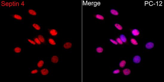 Immunocytochemistry/ Immunofluorescence: Septin-4 Antibody [NBP3-35109] - Immunofluorescence analysis of PC-12 cells using Septin-4 Rabbit pAb at dilution of 1:50 (40x lens). Secondary antibody: Cy3-conjugated Goat anti-Rabbit IgG (H+L) at 1:500 dilution. Blue: DAPI for nuclear staining.