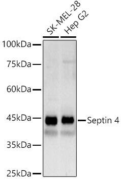 Western Blot: Septin-4 Antibody [NBP3-35109] - Western Blot analysis of various lysates using Septin-4 Rabbit pAb at 1:500 dilution. Secondary antibody: HRP-conjugated Goat anti-Rabbit IgG (H+L) at 1:10000 dilution. Lysates / proteins: 25 ug per lane. Blocking buffer: 3 % nonfat dry milk in TBST. Detection: ECL Basic Kit. Exposure time: 5s.