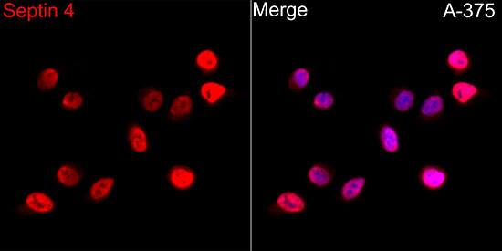 Immunocytochemistry/ Immunofluorescence: Septin-4 Antibody [NBP3-35109] - Immunofluorescence analysis of A-375 cells using Septin-4 Rabbit pAb at dilution of 1:50 (40x lens). Secondary antibody: Cy3-conjugated Goat anti-Rabbit IgG (H+L) at 1:500 dilution. Blue: DAPI for nuclear staining.