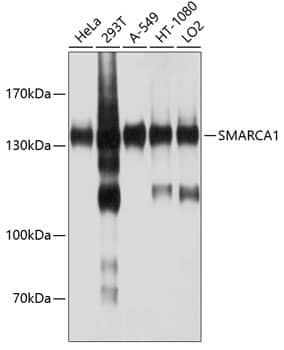 Western Blot: SMARCA1 Antibody [NBP3-35110] - Western blot analysis of various lysates using SMARCA1 Rabbit pAb at 1:1000 dilution.Secondary antibody: HRP-conjugated Goat anti-Rabbit IgG (H+L) at 1:10000 dilution.Lysates/proteins: 25ug per lane.Blocking buffer: 3% nonfat dry milk in TBST.Detection: ECL Basic Kit.Exposure time: 15s.