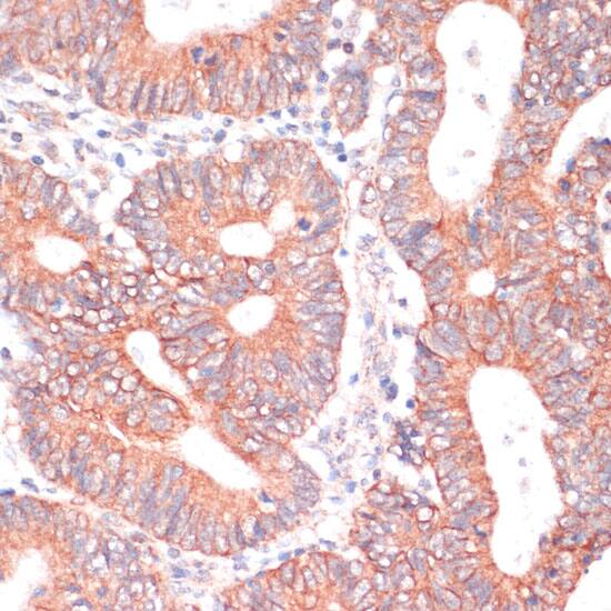 Immunohistochemistry TIAM1 Antibody