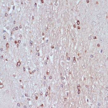 Immunohistochemistry: TPD52 Antibody [NBP3-35112] - Immunohistochemistry analysis of paraffin-embedded Rat brain using TPD52 Rabbit pAb at dilution of 1:100 (40x lens). Microwave antigen retrieval performed with 0.01M PBS Buffer (pH 7.2) prior to IHC staining.