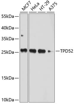 Western Blot: TPD52 Antibody [NBP3-35112] - Western blot analysis of various lysates using TPD52 Rabbit pAb at 1:1000 dilution.Secondary antibody: HRP-conjugated Goat anti-Rabbit IgG (H+L) at 1:10000 dilution.Lysates/proteins: 25ug per lane.Blocking buffer: 3% nonfat dry milk in TBST.Detection: ECL Basic Kit.Exposure time: 10s.