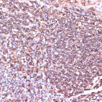 Immunohistochemistry: TPD52 Antibody [NBP3-35112] - Immunohistochemistry analysis of paraffin-embedded Human tonsil using TPD52 Rabbit pAb at dilution of 1:100 (40x lens). Microwave antigen retrieval performed with 0.01M PBS Buffer (pH 7.2) prior to IHC staining.