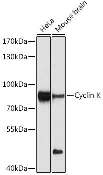 Western Blot: CCNK Antibody [NBP3-35113] - Western blot analysis of various lysates using CCNK Rabbit pAb at 1:1000 dilution.Secondary antibody: HRP-conjugated Goat anti-Rabbit IgG (H+L) at 1:10000 dilution.Lysates/proteins: 25ug per lane.Blocking buffer: 3% nonfat dry milk in TBST.Detection: ECL Enhanced Kit.Exposure time: 90s.