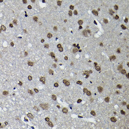 Immunohistochemistry: CCNK Antibody [NBP3-35113] - Immunohistochemistry analysis of paraffin-embedded Rat brain using CCNK Rabbit pAb at dilution of 1:100 (40x lens). High pressure antigen retrieval performed with 0.01M Citrate Bufferr (pH 6.0) prior to IHC staining.