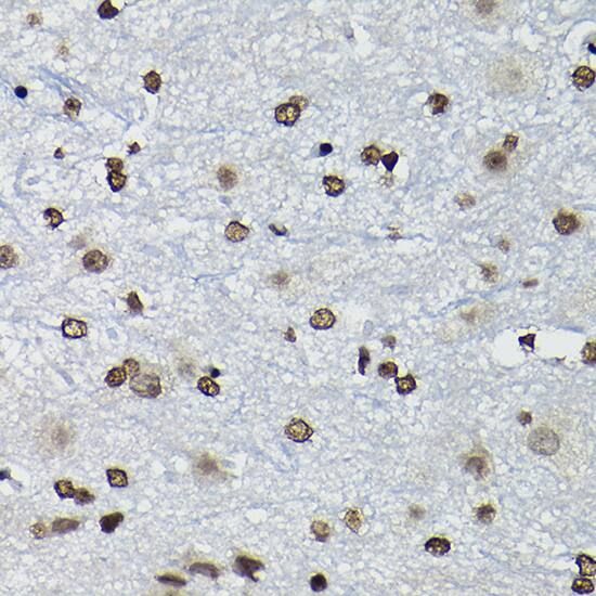 Immunohistochemistry: CCNK Antibody [NBP3-35113] - Immunohistochemistry analysis of paraffin-embedded Mouse spinal cord using CCNK Rabbit pAb at dilution of 1:100 (40x lens). High pressure antigen retrieval performed with 0.01M Citrate Bufferr (pH 6.0) prior to IHC staining.