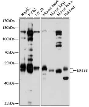 Western Blot: eIF2B3 Antibody [NBP3-35115] - Western blot analysis of various lysates using eIF2B3 Rabbit pAb at 1:1000 dilution.Secondary antibody: HRP-conjugated Goat anti-Rabbit IgG (H+L) at 1:10000 dilution.Lysates/proteins: 25ug per lane.Blocking buffer: 3% nonfat dry milk in TBST.Detection: ECL Basic Kit.Exposure time: 10s.