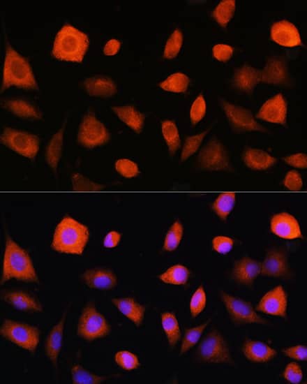 Immunocytochemistry/ Immunofluorescence: eIF2B epsilon Antibody [NBP3-35116] - Immunofluorescence analysis of L929 cells using eIF2B epsilon(eIF2B epsilon(EIF2B5)) Rabbit pAb at dilution of 1:100. Secondary antibody: Cy3-conjugated Goat anti-Rabbit IgG (H+L) at 1:500 dilution. Blue: DAPI for nuclear staining.