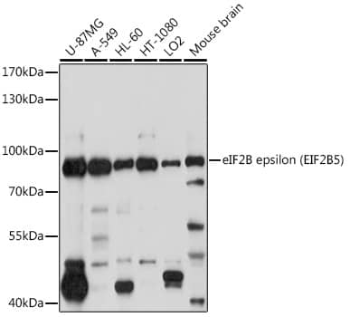 Western Blot: eIF2B epsilon Antibody [NBP3-35116] - Western blot analysis of various lysates using eIF2B epsilon(EIF2B5) Rabbit pAb at 1:1000 dilution.Secondary antibody: HRP-conjugated Goat anti-Rabbit IgG (H+L) at 1:10000 dilution.Lysates/proteins: 25ug per lane.Blocking buffer: 3% nonfat dry milk in TBST.Detection: ECL Basic Kit.Exposure time: 10s.